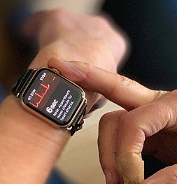 Функция ЭКГ в часах Apple Watch спасла человеку жизнь